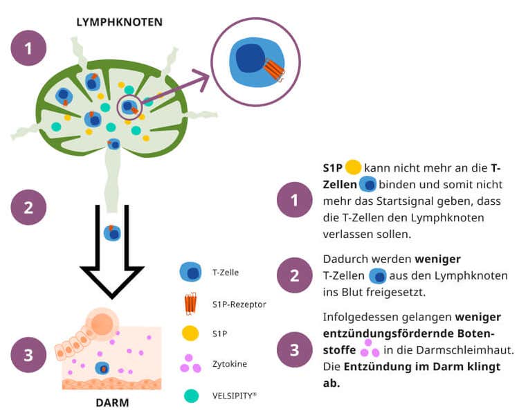 Lympfknoten